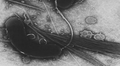 Vibrio_cholerae_2_red